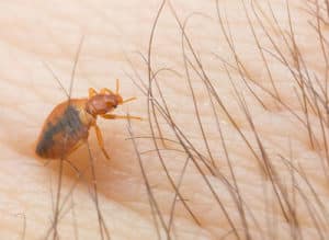 Picture Of Bed Bug On Human Skin